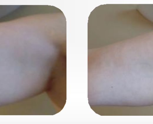 Starvac DX Twin - подвійна дія для ідеальної фігури | Alfaspa зображення 36