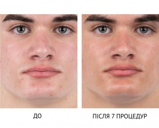 Мультиплатформа Bio-Penta Bio-Therapeutic - Купити в Україні | Alfaspa зображення 26