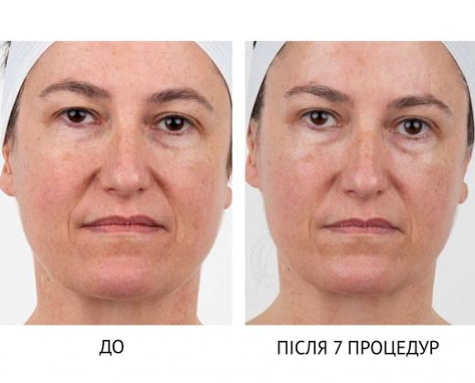 Мультиплатформа Bio-Penta Bio-Therapeutic - Купити в Україні | Alfaspa зображення 27