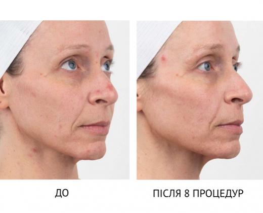 Мультиплатформа Bio-Penta Bio-Therapeutic - Купити в Україні | Alfaspa зображення 28