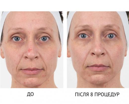 Мультиплатформа Bio-Penta Bio-Therapeutic - Купити в Україні | Alfaspa зображення 29