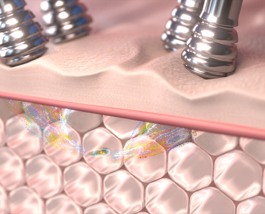 BT-Sculpt GEN2: Обладнання Bio-Therapeutic | Alfaspa зображення 23