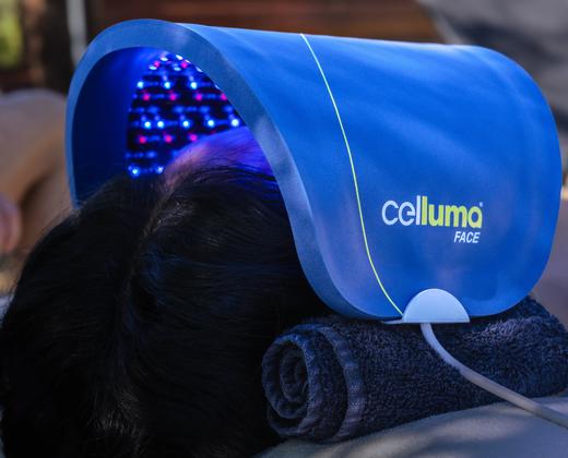 Celluma FACE Series 2 — LED терапія для обличчя | Лікування акне та зморшок | FDA, CE світлотерапія | Alfaspa зображення 22