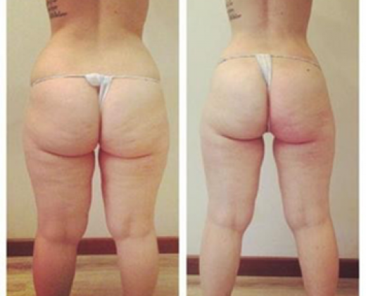 Купити апарат Starvac DX Smart | Alfaspa зображення 31