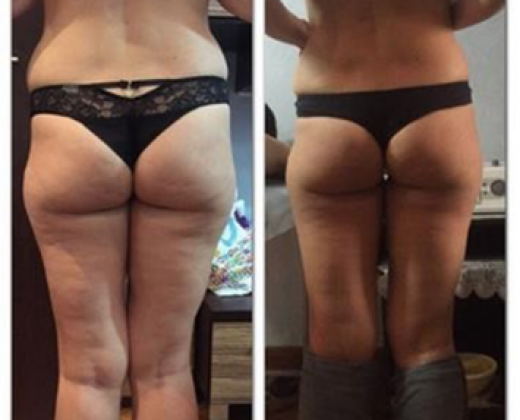 Купити апарат Starvac DX Smart | Alfaspa зображення 32