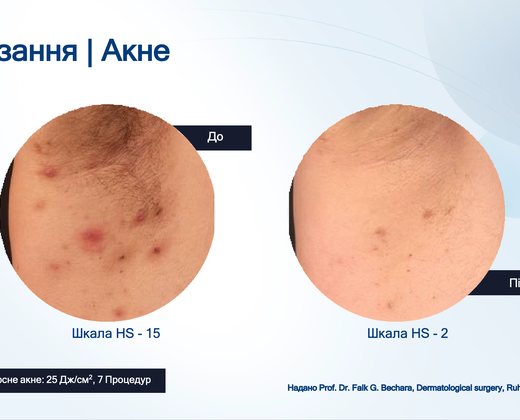 Лазер Asclepion The EpiLab 2023 ➔ купить в Украине | Alfaspa изображение 36