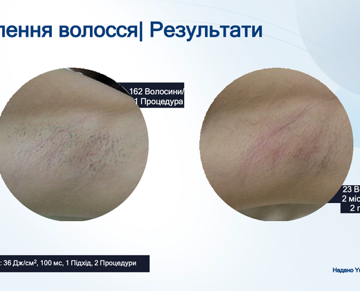 Лазер Asclepion The EpiLab 2023 ➔ купить в Украине | Alfaspa изображение 35