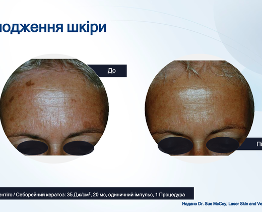 Лазер Asclepion The EpiLab 2023 ➔ купить в Украине | Alfaspa изображение 37