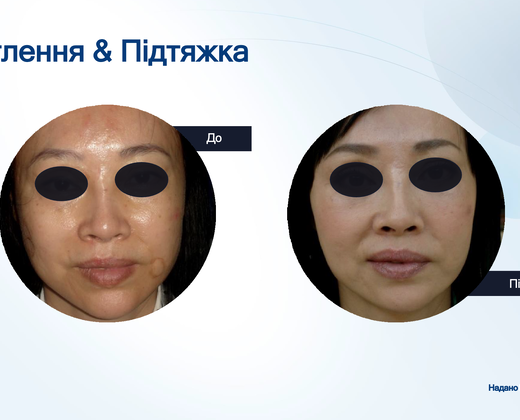 Лазер Asclepion The EpiLab 2023 ➔ купить в Украине | Alfaspa изображение 38