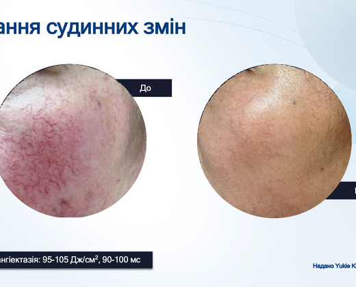 Лазер Asclepion The EpiLab 2023 ➔ купить в Украине | Alfaspa изображение 39