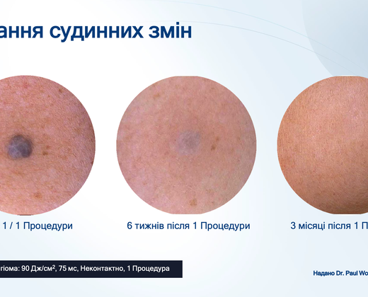 Лазер Asclepion The EpiLab 2023 ➔ купить в Украине | Alfaspa изображение 34