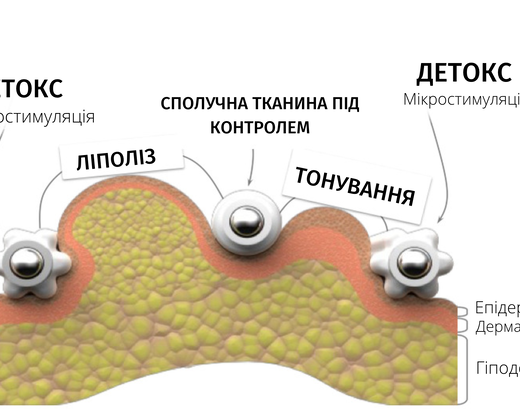 Starvac DX Focus - Купити в Україні | Alfaspa зображення 25