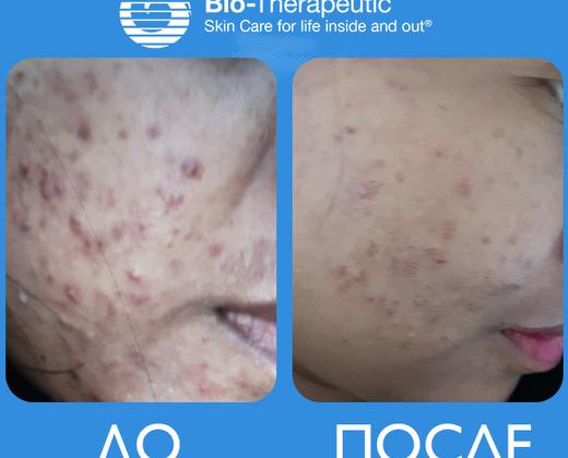 Купити апарат LED хромотерапії Bio-Synthesis | Alfaspa зображення 27