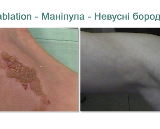 Asclepion MultiPulse PRO ➜ Профессиональный CO2 лазер в Украине | Alfaspa изображение 31