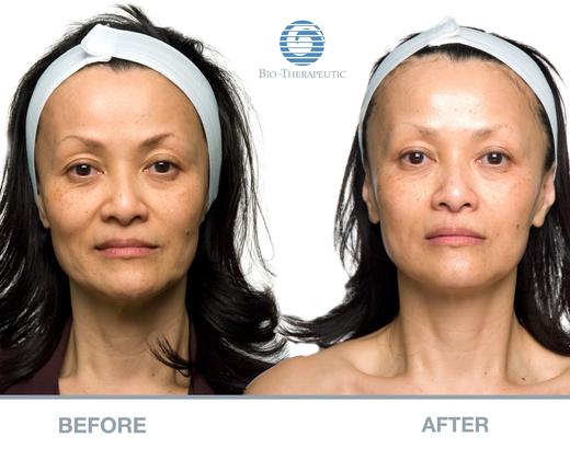 Апарат мікрострумової терапії Bio-Ultimate Platinum | Alfaspa зображення 40