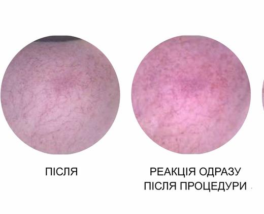 Жовтий лазер Asclepion QuadrostarPRO Yellow 577нм ➔ купити в Україні | Alfaspa зображення 35