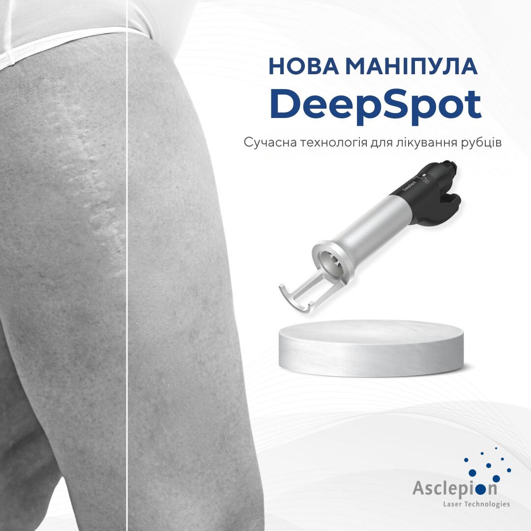 Asclepion Dermablate ➜ Аппарат для лазерной шлифовки кожи лица, купить в Украине | Alfaspa изображение 16