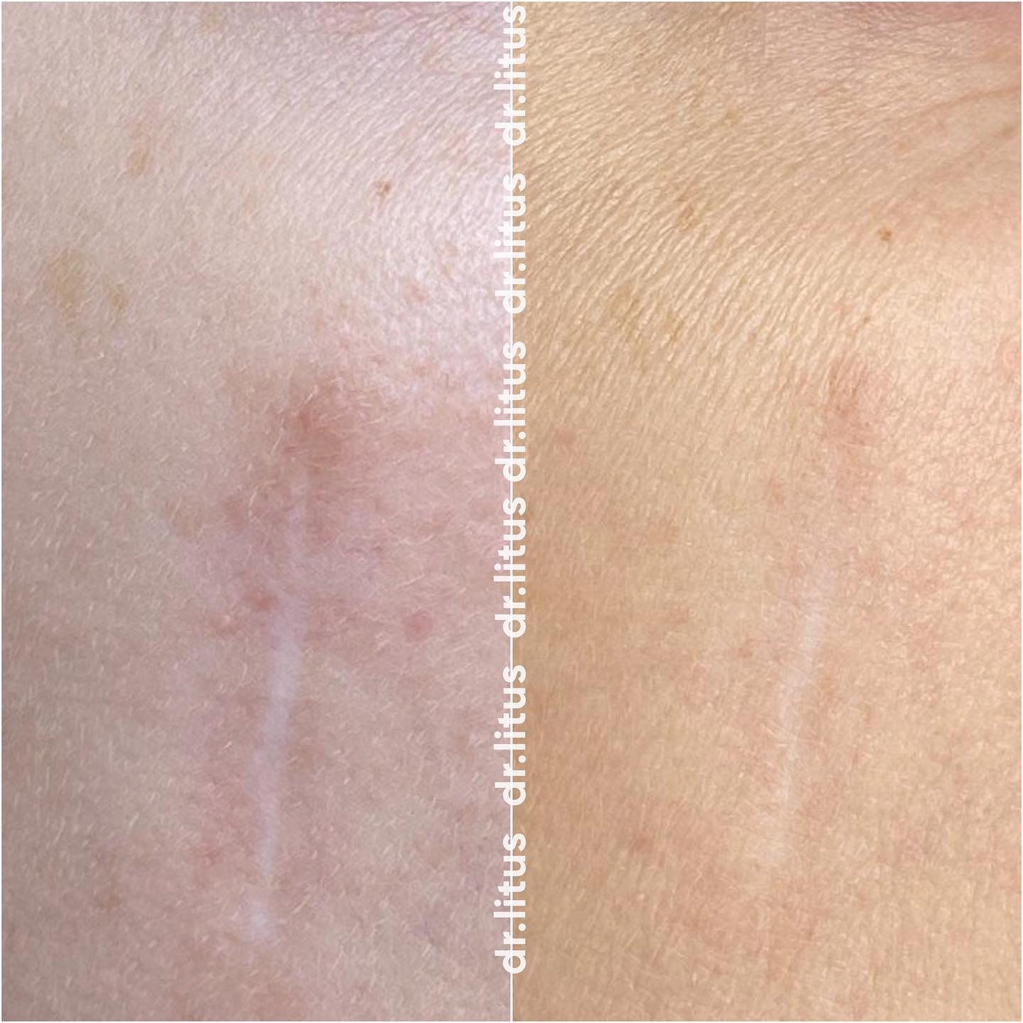 Ирина Литус рекомендует оборудование от ALFA Development | Alfaspa изображение 4