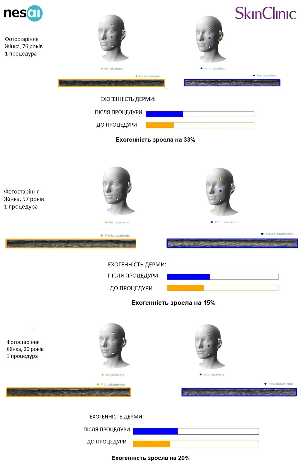 Exosomes Cocktail от Skin Clinic: новая эра в регенеративной медицине | Alfaspa изображение 3