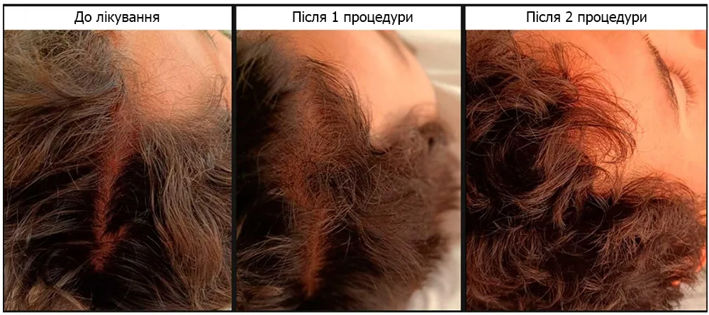 Exosomes Cocktail от Skin Clinic: новая эра в регенеративной медицине | Alfaspa изображение 4