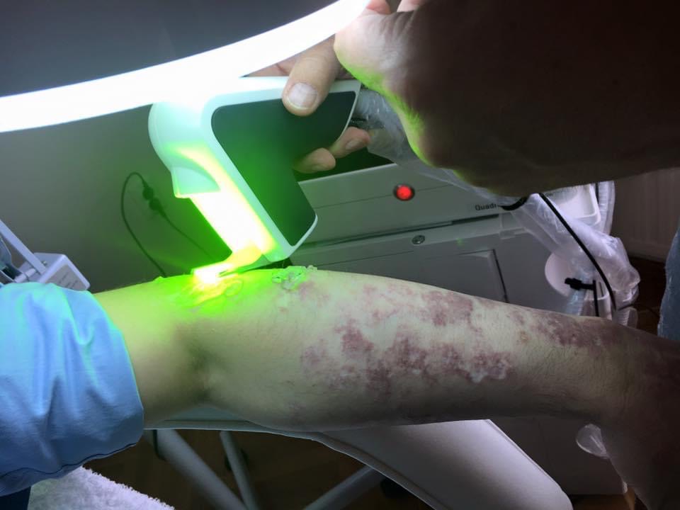 Елена Дерновшек: я фанат лазеров! | Alfaspa изображение 9