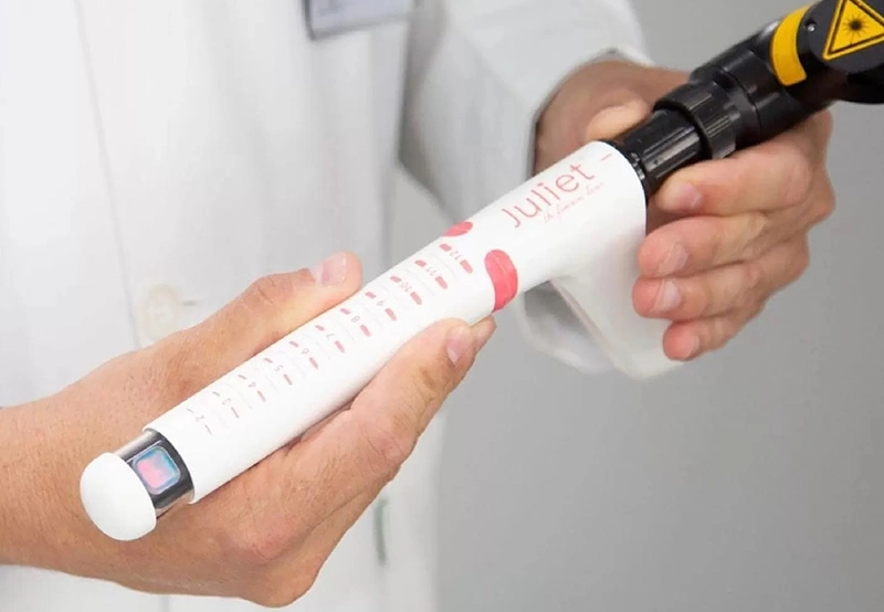 Интимное омоложение – как это происходит? | Alfaspa изображение 3