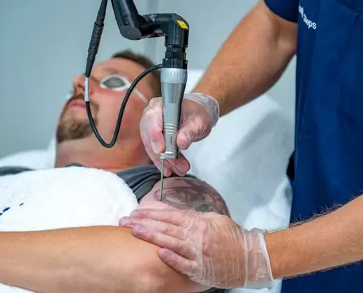 Аппараты для лазерной косметологии: виды, особенности, преимущества | Alfaspa изображение 5