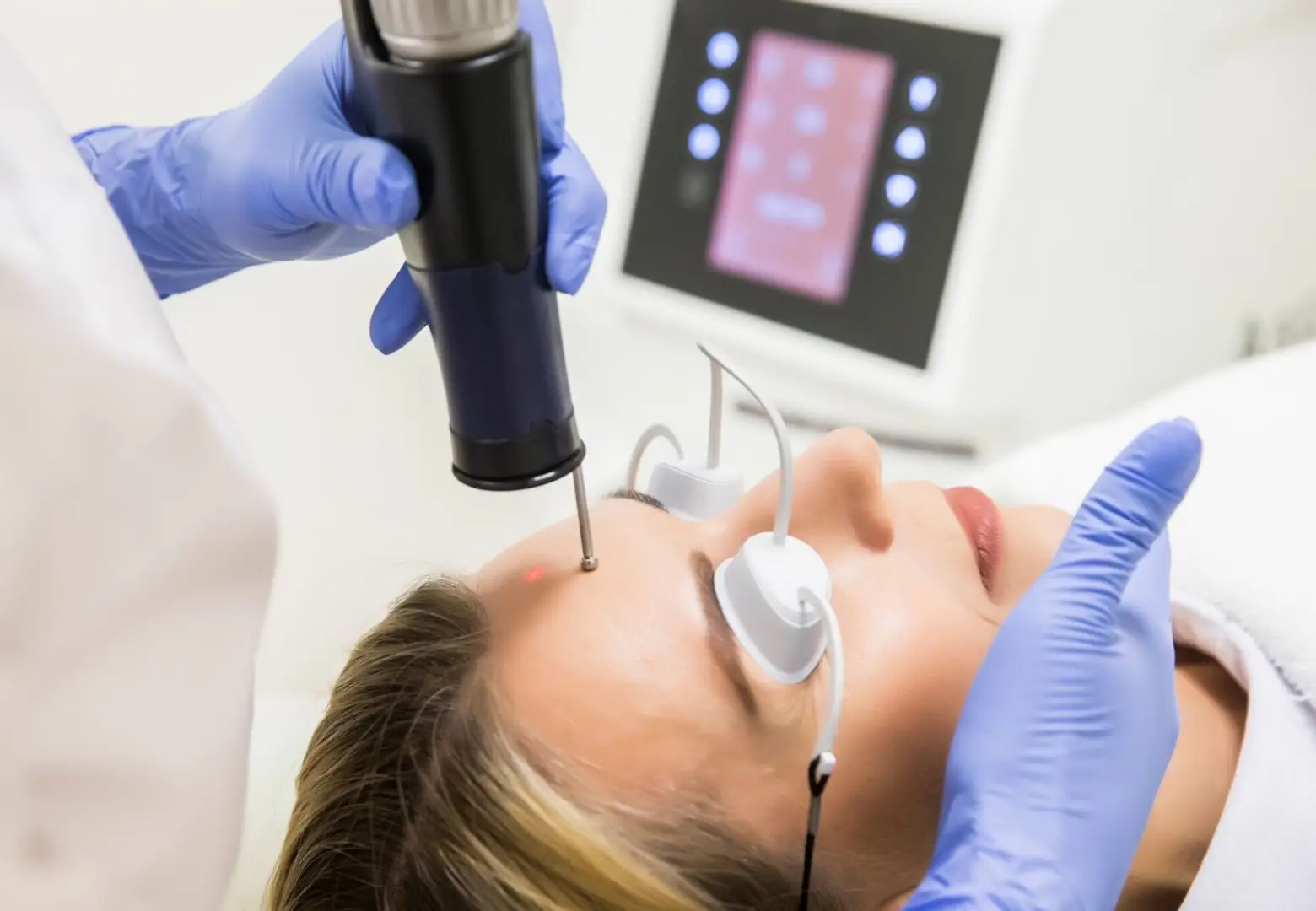 Исследование технологии IPDL VELOCE для лечения акне, рубцов после акне и подтяжки кожи | Alfaspa изображение 5