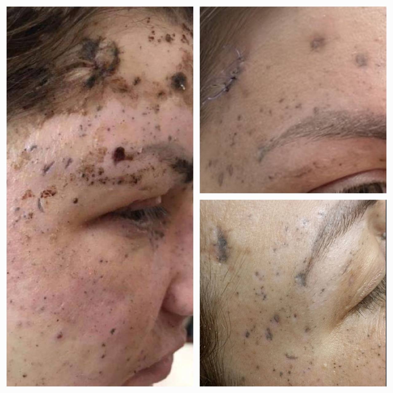 Averina Clinic бесплатно лечат посттравмы | Alfaspa изображение 2