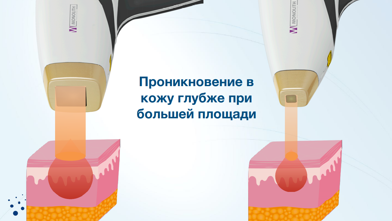 Почему сетевые клиники выбирают лазеры Asclepion для эпиляции? Обзор аппаратов | Alfaspa изображение 7