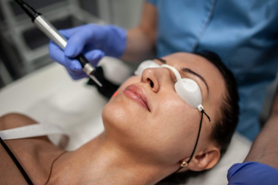 Идеальная кожа: все, что нужно знать о куперозе, пигментации и удалении сосудов | Alfaspa изображение 10