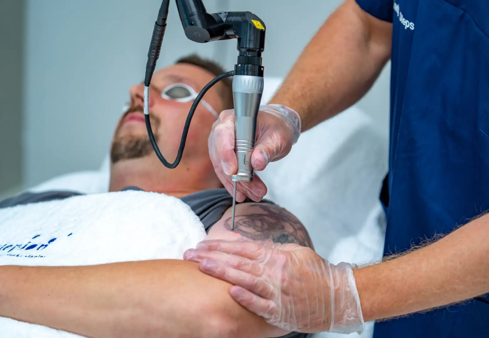 Пикосекундный лазер: показания, противопоказания и эффективность | Alfaspa изображение 3