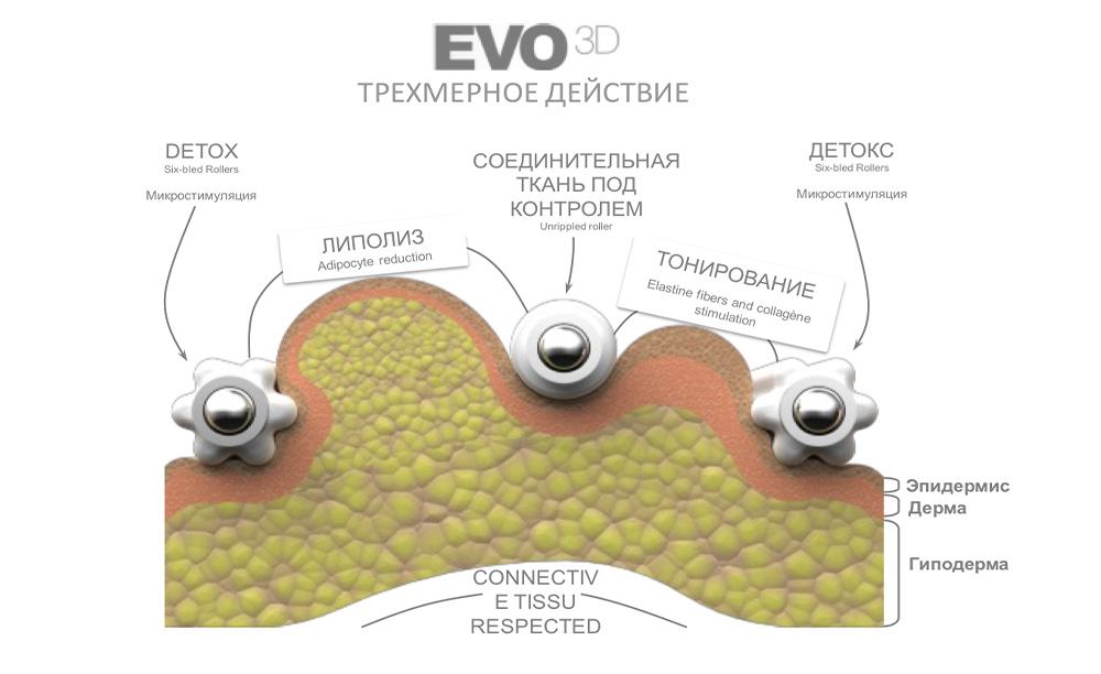 Аппаратная коррекция фигуры: как выбрать универсальный аппарат | Alfaspa изображение 4