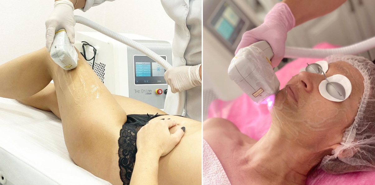 Lace Beauty Space | Alfaspa изображение 6