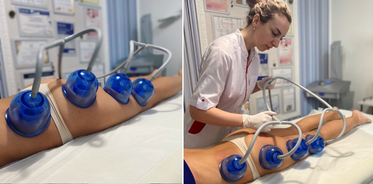 Lace Beauty Space | Alfaspa изображение 9