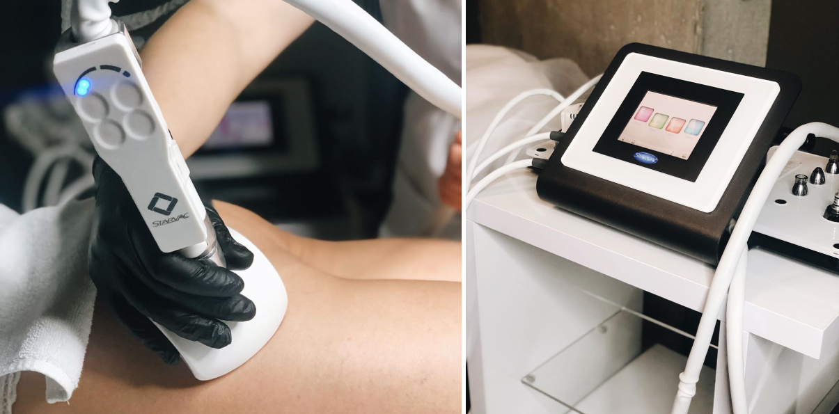 V.angel.bysergienko | Alfaspa изображение 6