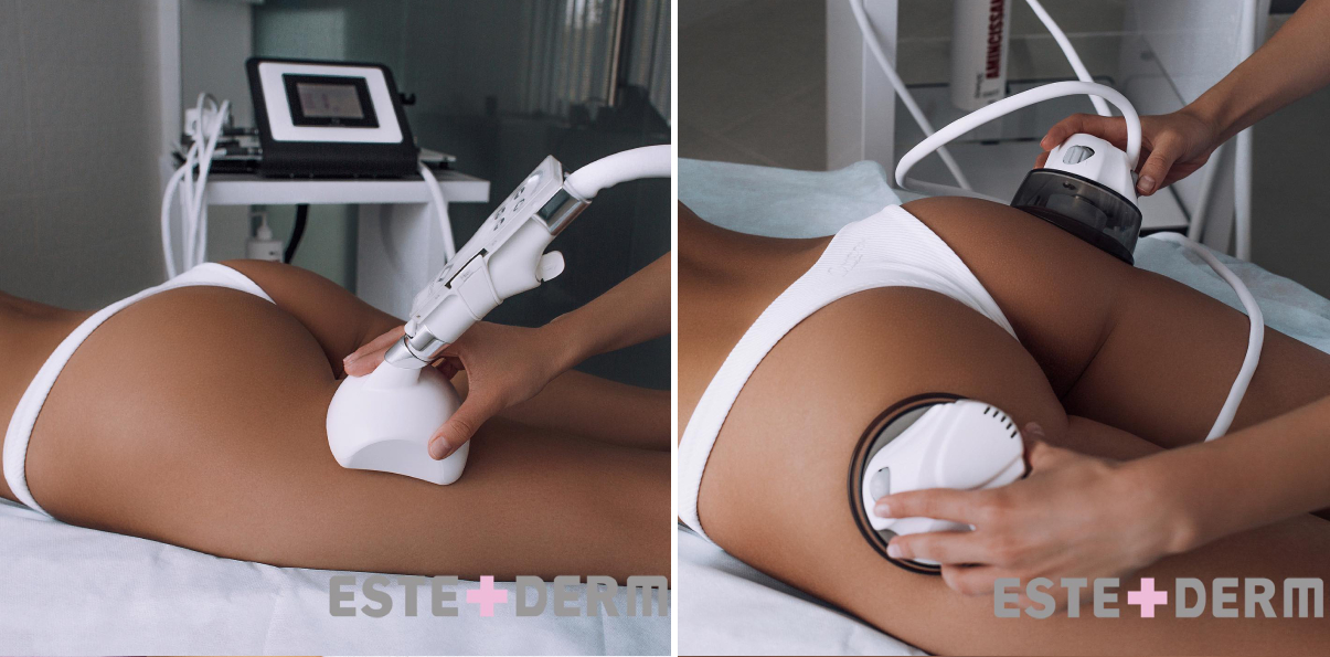 Estederm: Медицинский Центр Дерматологии и Косметологии | Alfaspa изображение 6