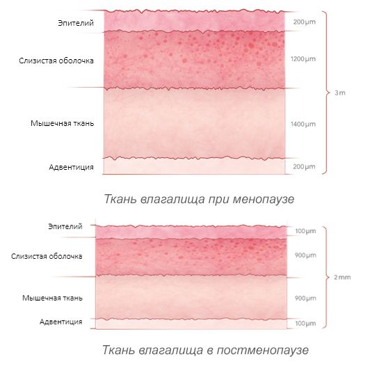 Asclepion MCL31 Juliet ➜ Аппарат для интимного омоложения, купить в Украине | Alfaspa изображение 21