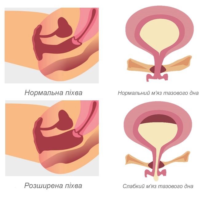Asclepion MCL31 Juliet ➜ Апарат для інтимного омолодження, купити в Україні | Alfaspa зображення 22
