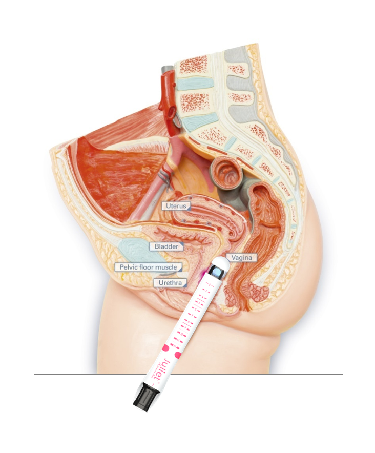 Asclepion MCL31 Juliet ➜ Аппарат для интимного омоложения, купить в Украине | Alfaspa изображение 18