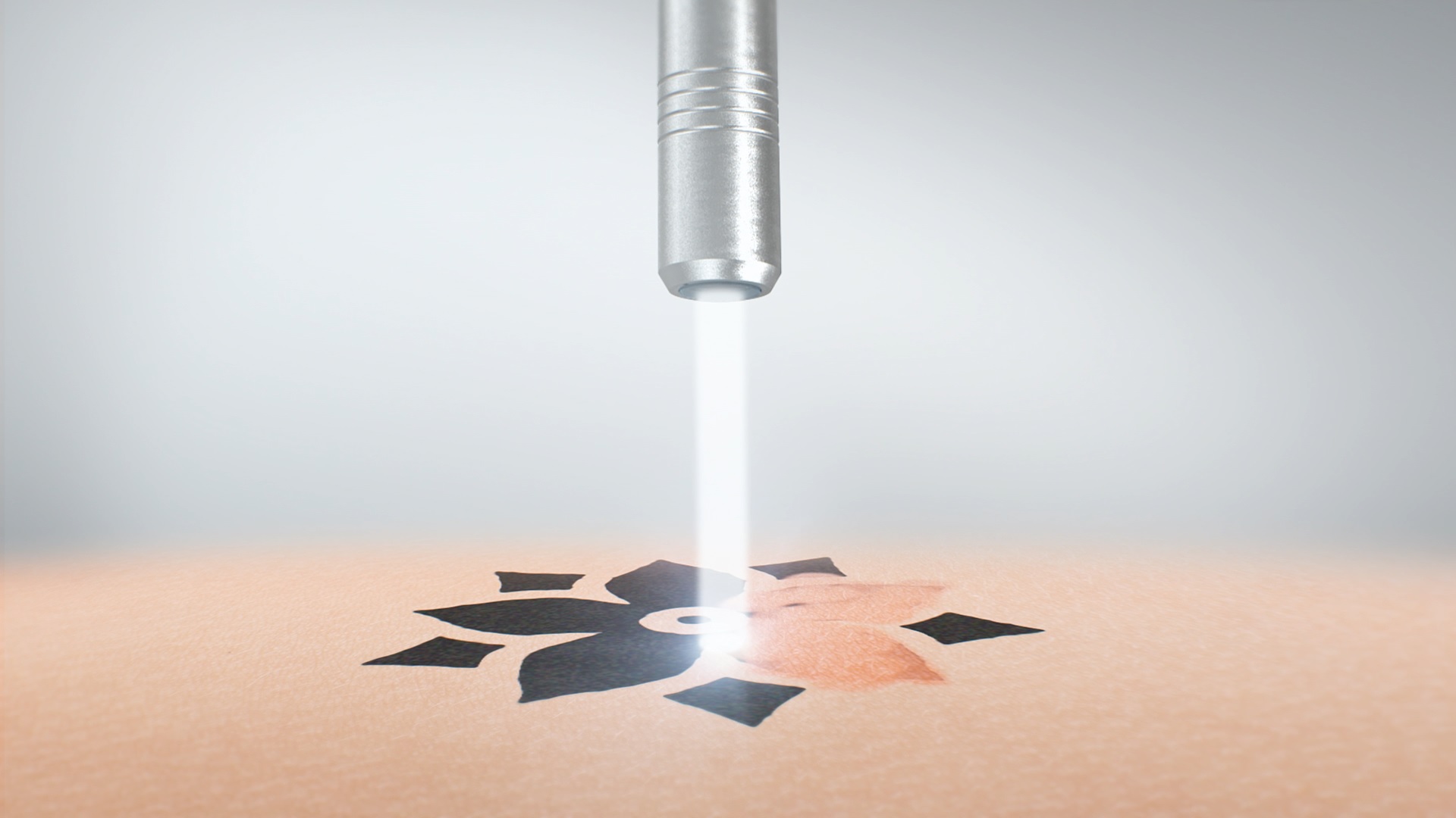 Пікосекундний лазер для видалення тату Asclepion PicoStar ➔ купити в Україні | Alfaspa зображення 17