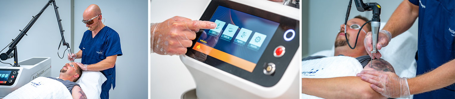 Пікосекундний лазер для видалення тату Asclepion PicoStar ➔ купити в Україні | Alfaspa зображення 18