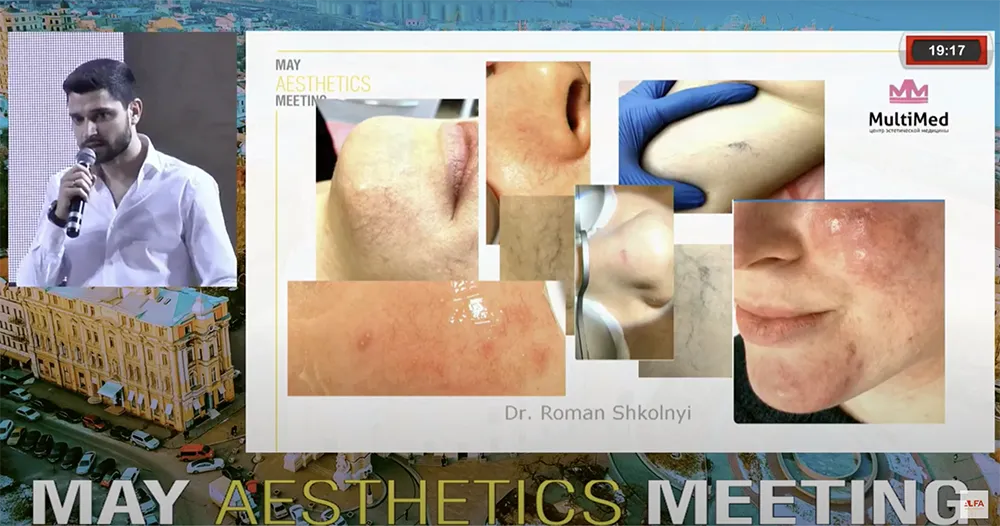 Жовтий лазер Asclepion QuadrostarPRO Yellow 577нм ➔ купити в Україні | Alfaspa зображення 41