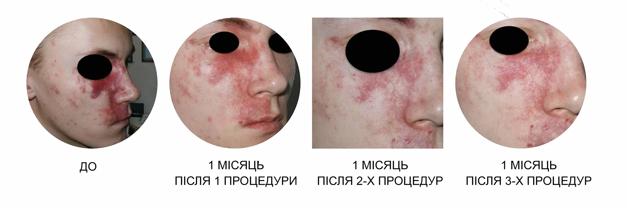 Жовтий лазер Asclepion QuadrostarPRO Yellow 577нм ➔ купити в Україні | Alfaspa зображення 19