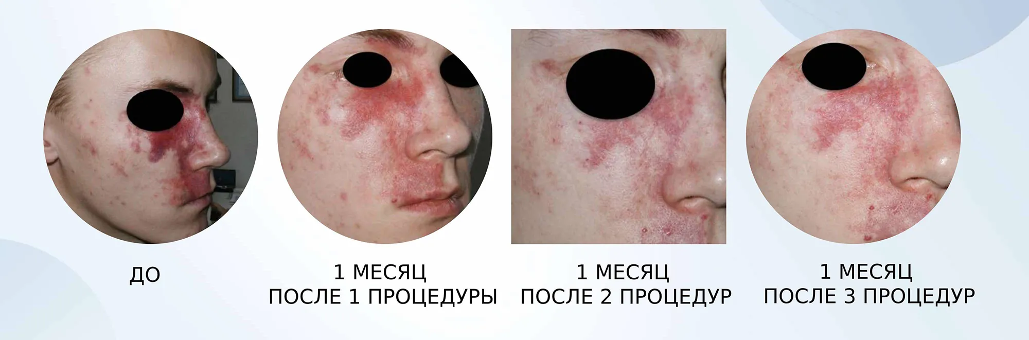 Жёлтый лазер Asclepion QuadrostarPRO Yellow 577 нм ➔ купить в Украине | Alfaspa изображение 19