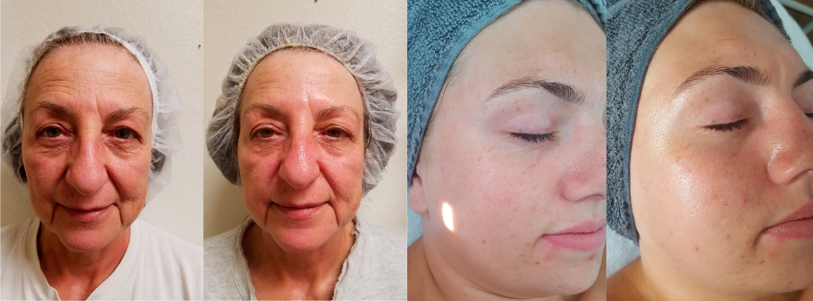 Апарат мікрострумової терапії Bio-Ultimate Platinum | Alfaspa зображення 20