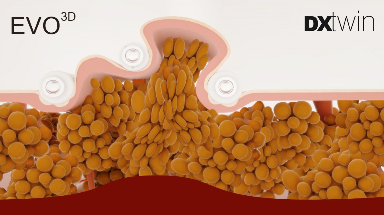 Starvac DX Twin - подвійна дія для ідеальної фігури | Alfaspa зображення 54