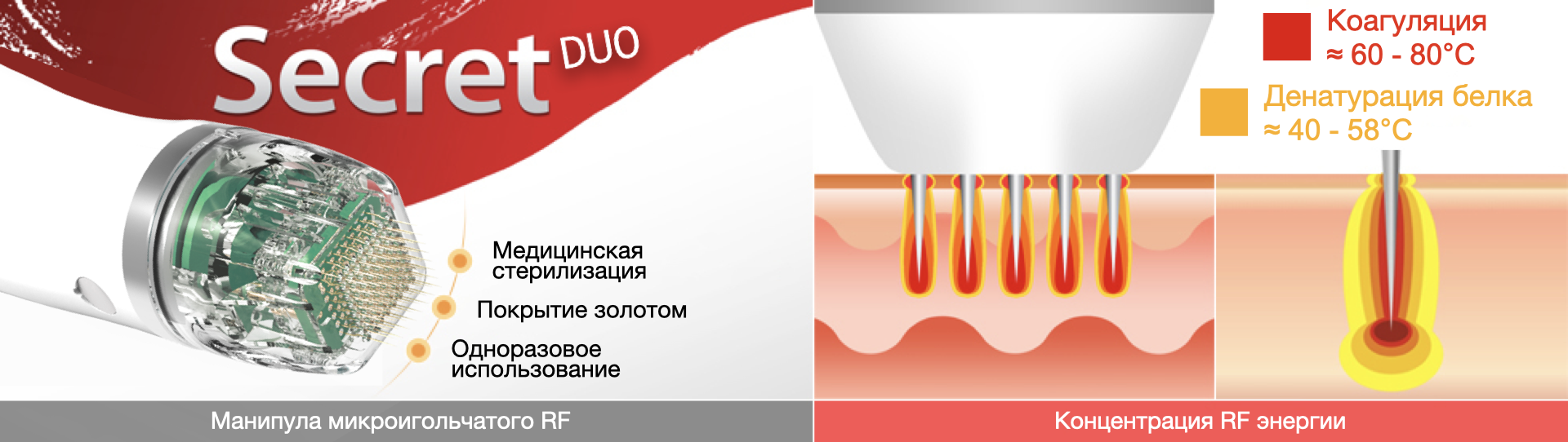 Купить аппарат для фракционного омоложения Classys Secret DUO в Украине | Alfaspa изображение 38
