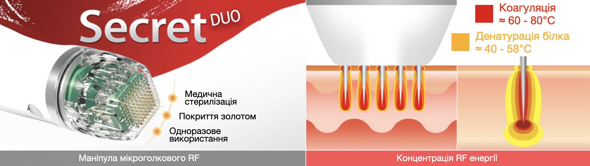 Купити апарат для фракційного омолодження Classys Secret DUO в Україні | Alfaspa зображення 38