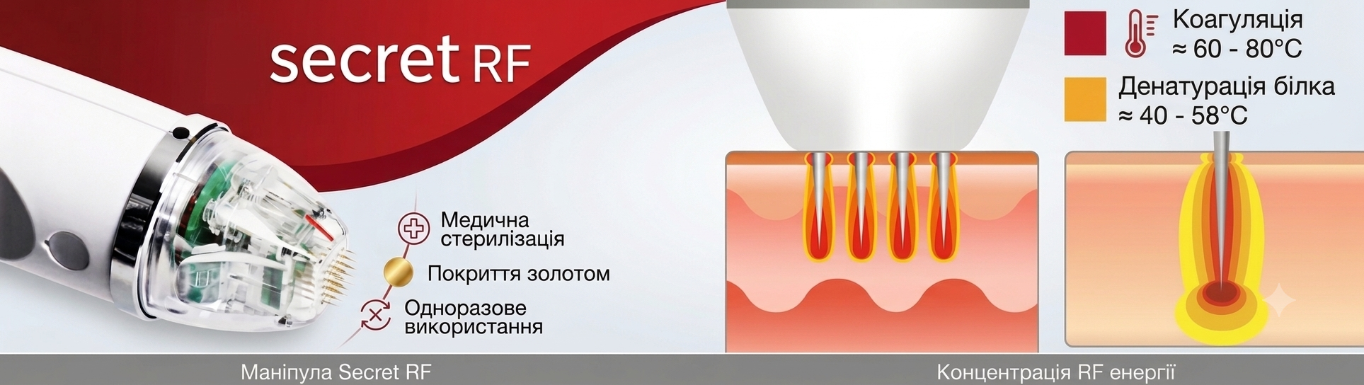 Classys Secret RF: Апарат фракційного RF-ліфтингу ➔ купити в Україні | Alfaspa зображення 18
